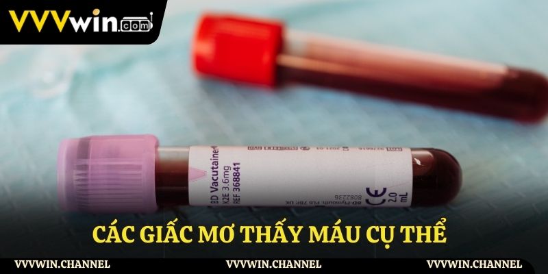 Ý nghĩa chi tiết của những giấc mơ thấy máu
